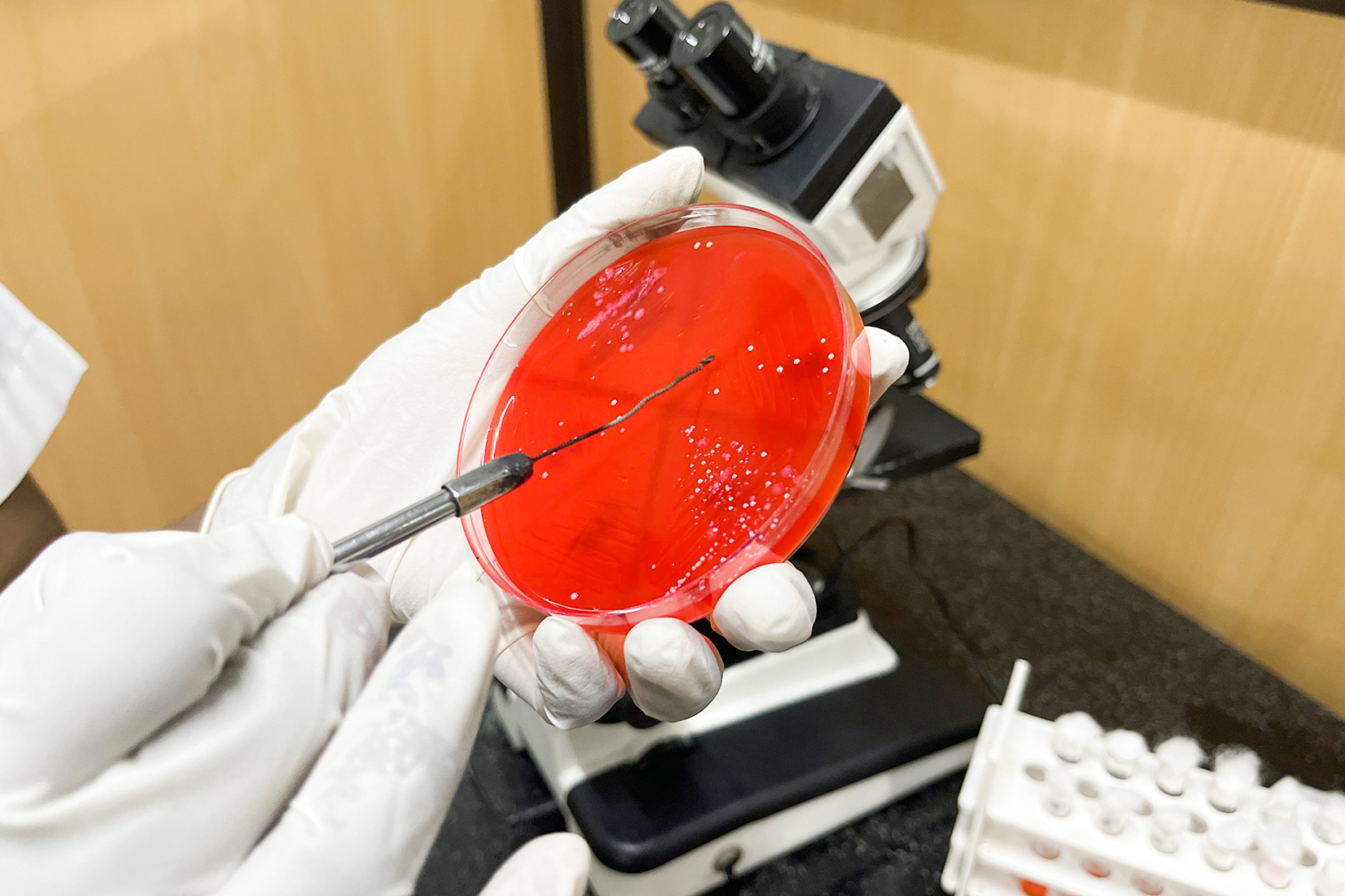 serology